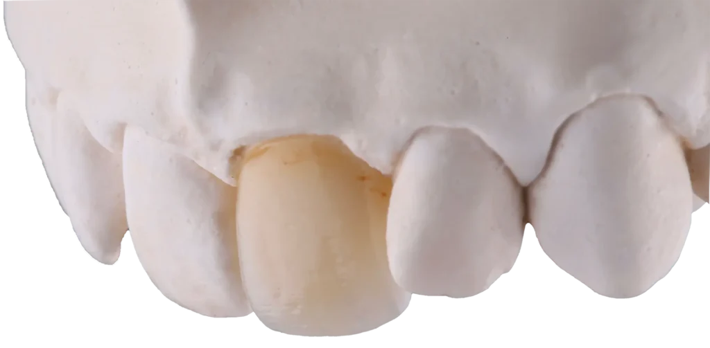ZIRCODENT EOS (4)