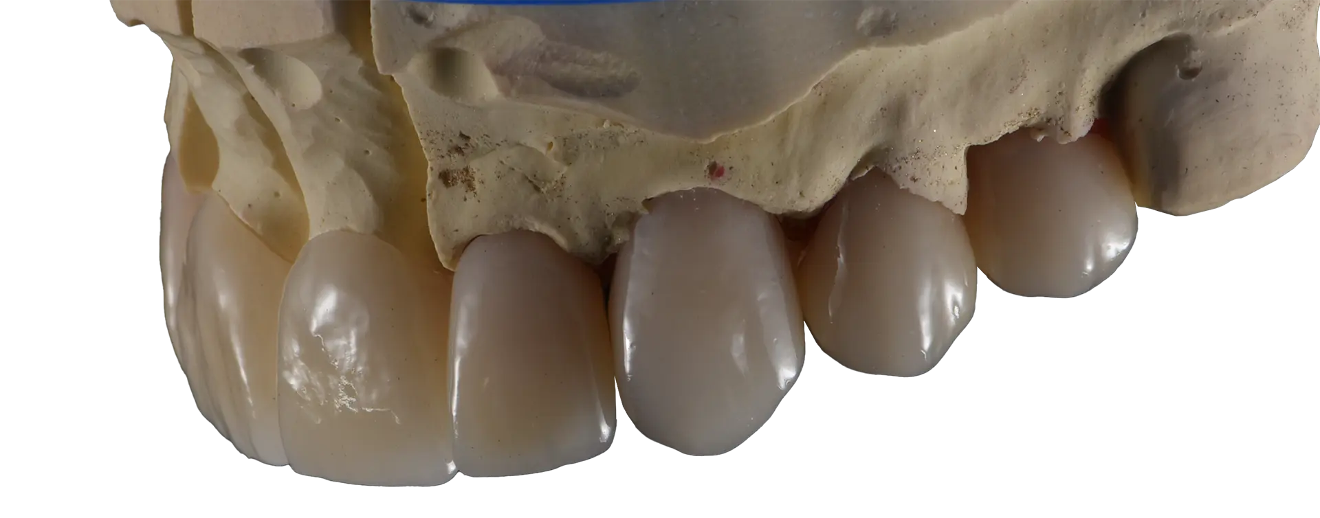 venus-orodent-realizzazione